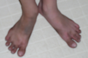 filthy feet