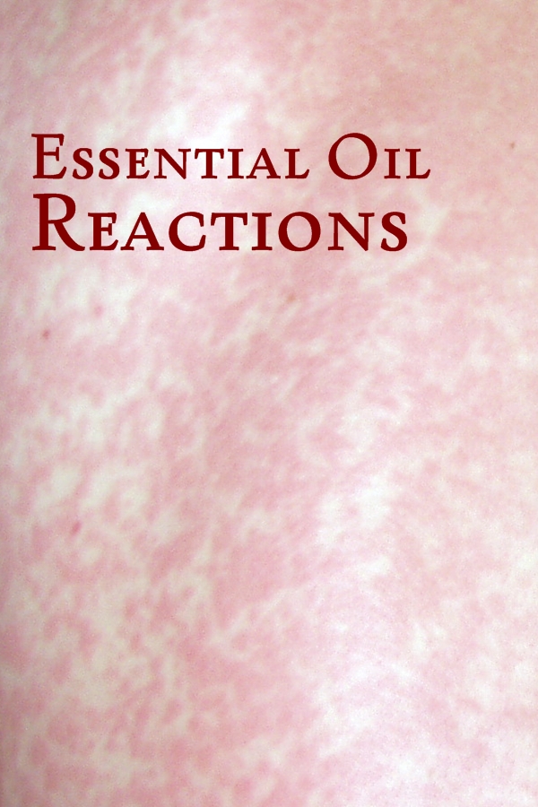 Essential Oil Reactions -- Titus 2 Homemaker